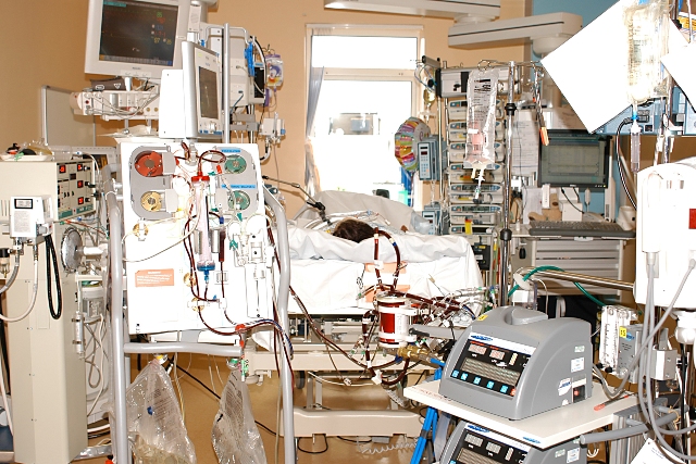 Venoarterial ECMO and Continuous Haemofiltration in use on a critically ill child